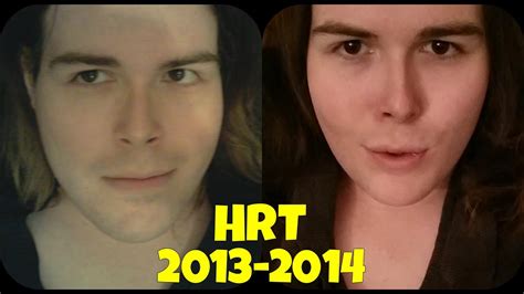 MTF Transgender Transition 1 Year On HRT Hormones Update YouTube