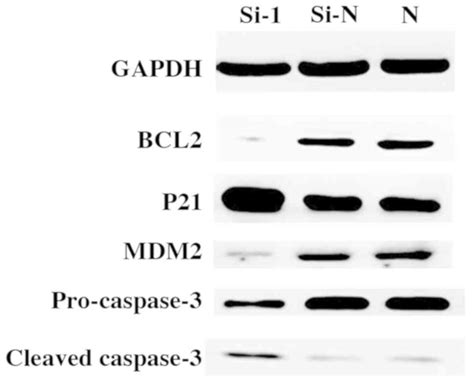 Tip60‑sirna Regulates Abce1 Acetylation To Suppress Lung Cancer Growth