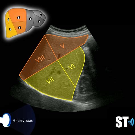 Couinauds Liver Segments Sonographic Tendencies