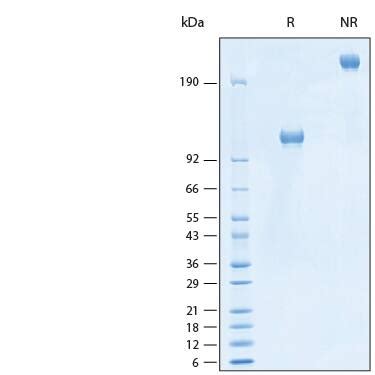 Recombinant Human Alcam Cd Fc Chimera Avi Tag Protein Cf Avi