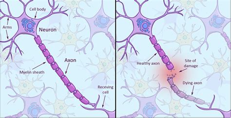 Why Doesnt Your Brain Heal Like Your Skin · Frontiers For Young Minds