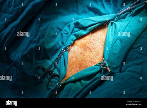 Surgical Area Of A Dog In A Surgery Stock Photo Alamy