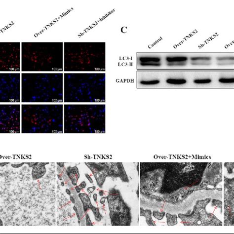 Down Regulation Of Tnks Induced Autophagy In Macrophages Regulated By