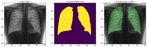 Lung Segmentation