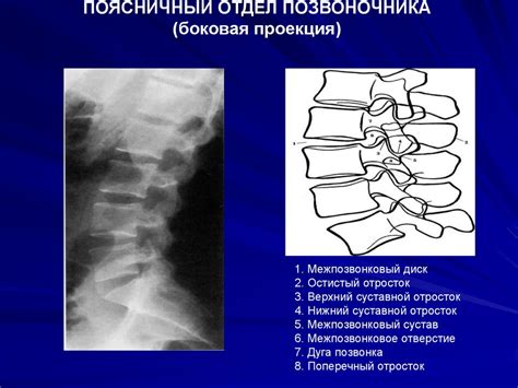 Шестой шейный позвонок, vertebra cervicalis (CVI); вид спереди ...