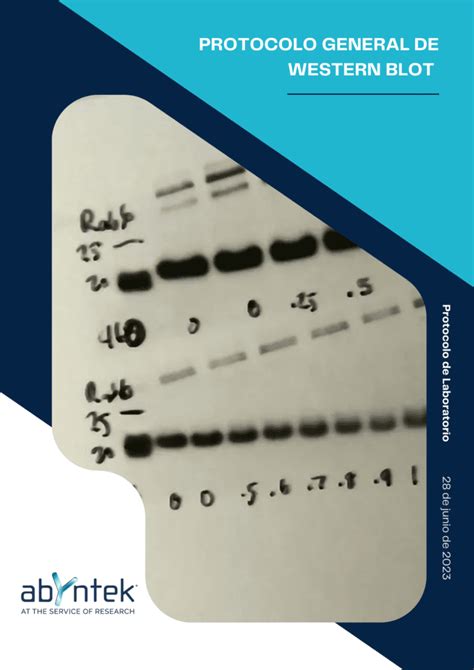 Protocolo Para Western Blot Abyntek Biopharma