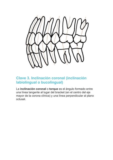 Las Seis Claves De La Oclusión Normal En Ortodoncia Pdf