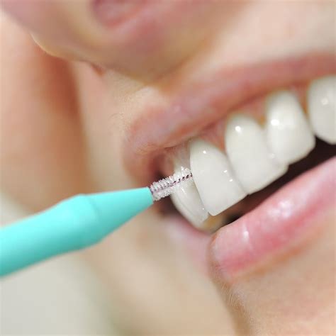 Escova Interdental O Que E Como Usar