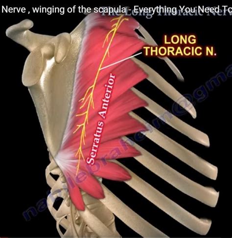 Long Thoracic Nerve Entrapment