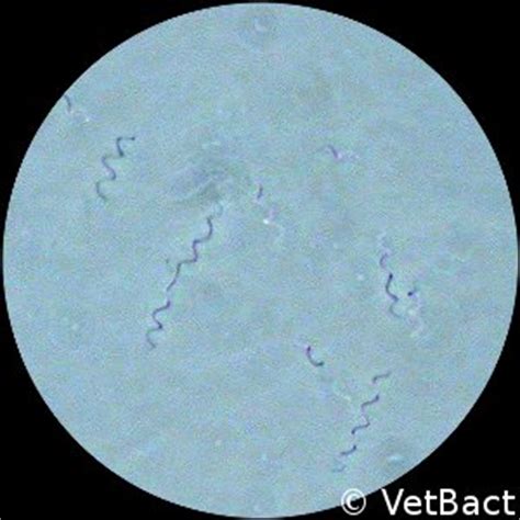 borrelia burgdorferi gram negative | cuzdek