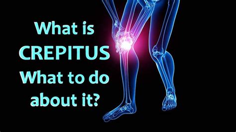 What Is Crepitus And What You Can Do About It What You Can Do Health