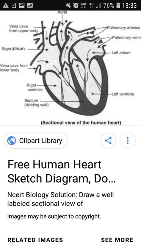 Draw A Sectional View Of The Human Heart And Label On It 1 Pulmonary