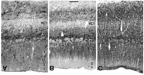 Sections from the calcarine fissure of a single human occipital lobe ...