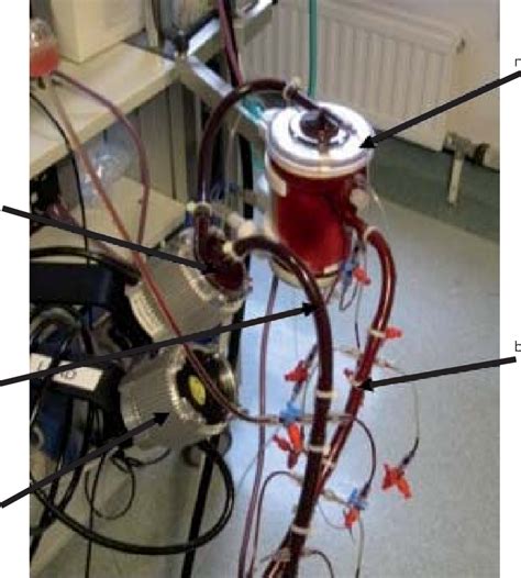 Typical Extracorporeal Membrane Oxygen Circuit Centrimag Is