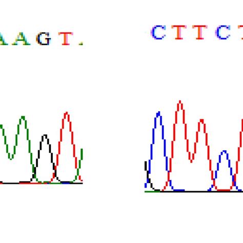 Direct Dna Sequencing Result For Il Rs Polymorphism A The