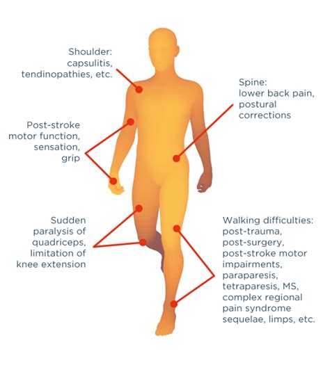 Motor Disorders : recover your mobility with ALLYANE