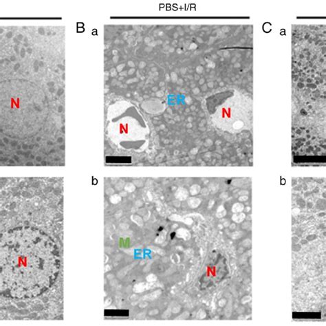 Ultrastructure Morphological Analysis Of Hepatocytes Isolated From Download Scientific Diagram