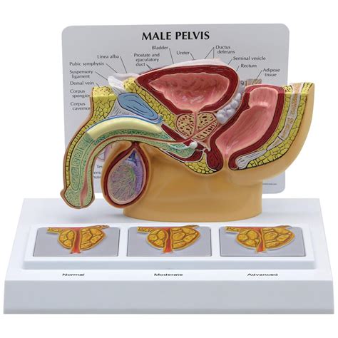 Male Pelvis With 3d Prostate Frame 1019563 3551 Genital And