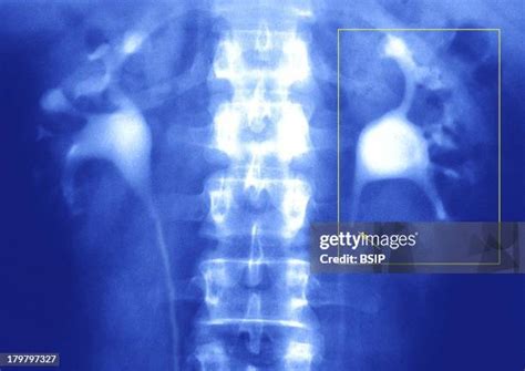 45 Excretory Duct Stock Photos High Res Pictures And Images Getty