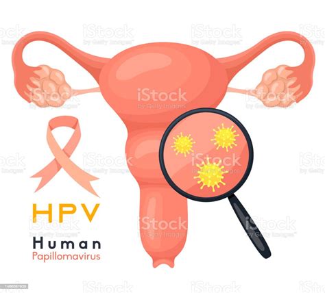 Concept De Santé Des Femmes Virus Du Papillome Humain Provoque Le