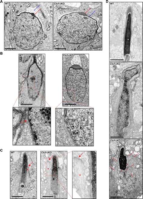 Elongated Spermatids Show Chromatin Compaction And Sperm Head Defects