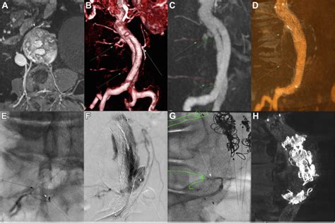 Image Guidance Techniques And Treatment Approach Optimization In The