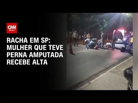 Mulher que teve perna amputada após ser atingida em suposto racha