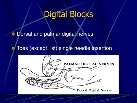 PPT - Nerve Blocks PowerPoint Presentation - ID:6088129