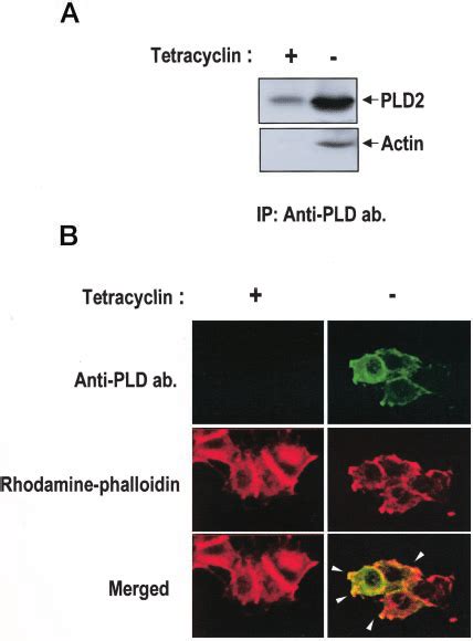 Specific Interaction Of Pld2 With The Actin Cytoskeleton In Pc12 Cells