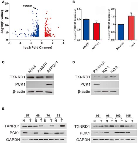 Frontiers Pck Downregulation Promotes Txnrd Expression And Hepatoma