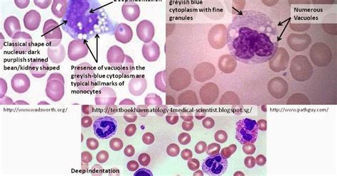 Haematology In A NutShell Monocytes