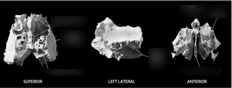 Ethmoid Bone Diagram | Quizlet