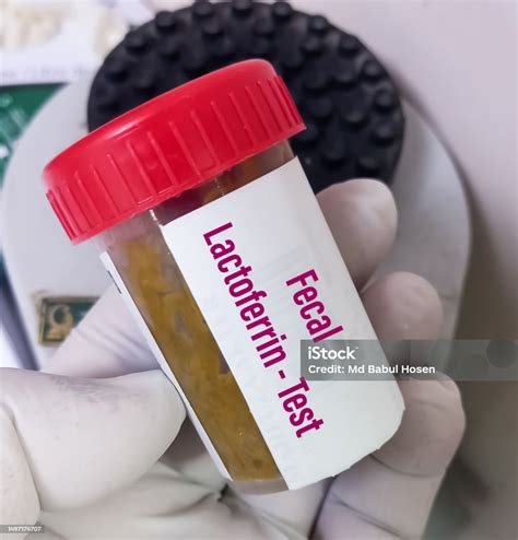 Stool Sample For Lactoferrin Test To Screen For Inflammatory Bowel Disease Fecal Lactoferrin ...