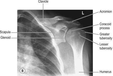 The Shoulder Girdle Radiology Key