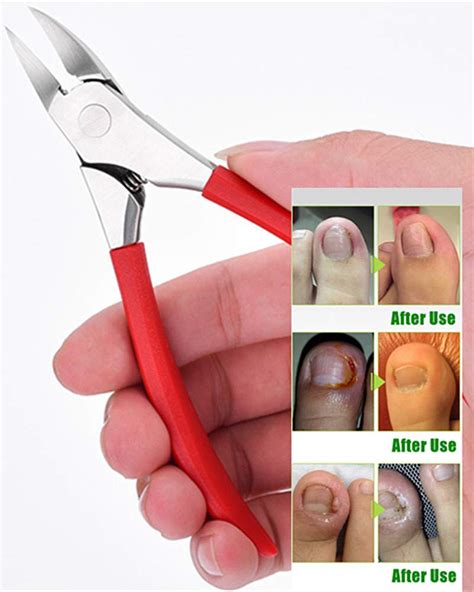 Buy Toenail Clippers For Thick Or Ingrown Toenails Yeesam Precision