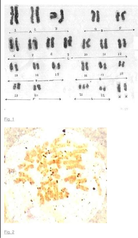 Figure 2 From Human Acrocentric Chromosome And Their Association With Nucleolar Organizer