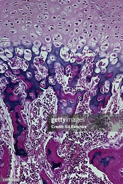 Endochondral Bone Formation Histology