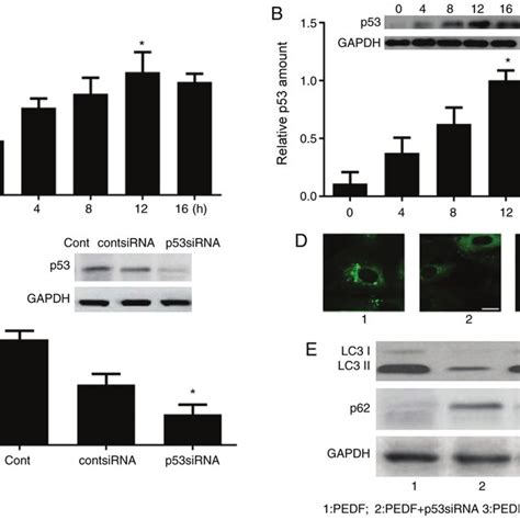 P53 Is Critical For Pedf Induced Autophagy Human Umbilical Vein Download Scientific Diagram