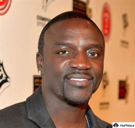 Akon Hair Transplant What Went Wrong