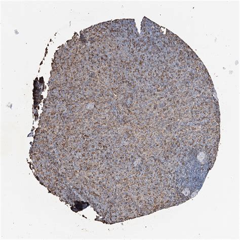 Tissue Expression Of HBA1 Staining In Spleen The Human Protein Atlas