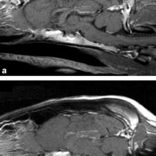 Sagittal T1 Weighted Post Gadolinium Administration MRI Images Display