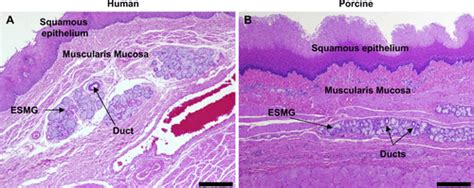 Esophageal Glands Histology