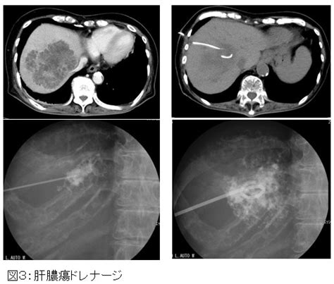 超音波検査を用いた診断・治療｜診療部 消化器内科｜明石医療センター