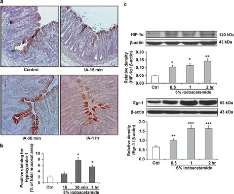 Colonic Hypoxia And Expression Of Hypoxia Related Transcription Factors