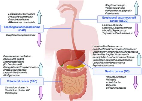 Overview On Microbiota And Cancers Of The Luminal GI Tract Bacterial