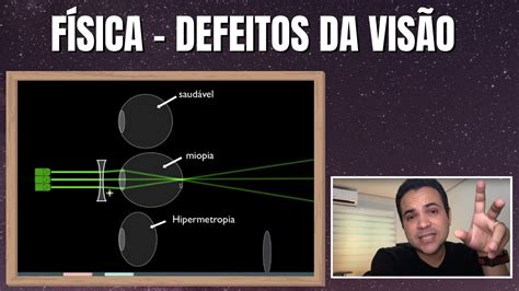 DEFEITOS DA VISÃO MIOPIA E HIPERMETROPIA AULA DE FÍSICA YouTube