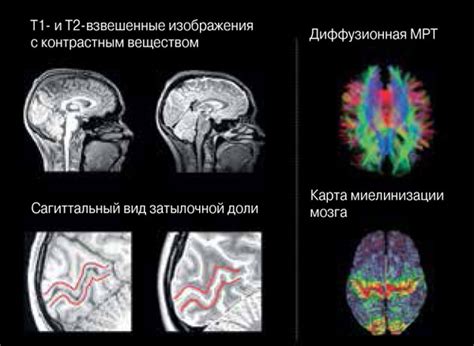 Влияние глазных болезней на головной мозг | OCHKI.com