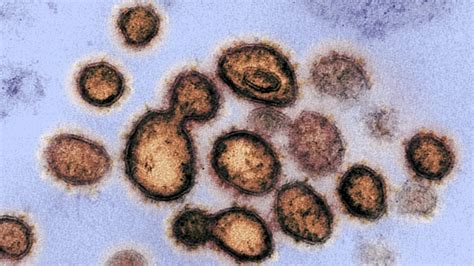 Coronavirus Le Sch Ma De L Volution Du Covid Devenu Viral Sur