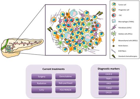 Stages Of Pancreatic Cancer