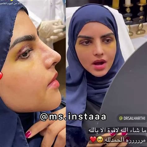 سارة الودعاني بعد التجميل فيديو Dailymotion